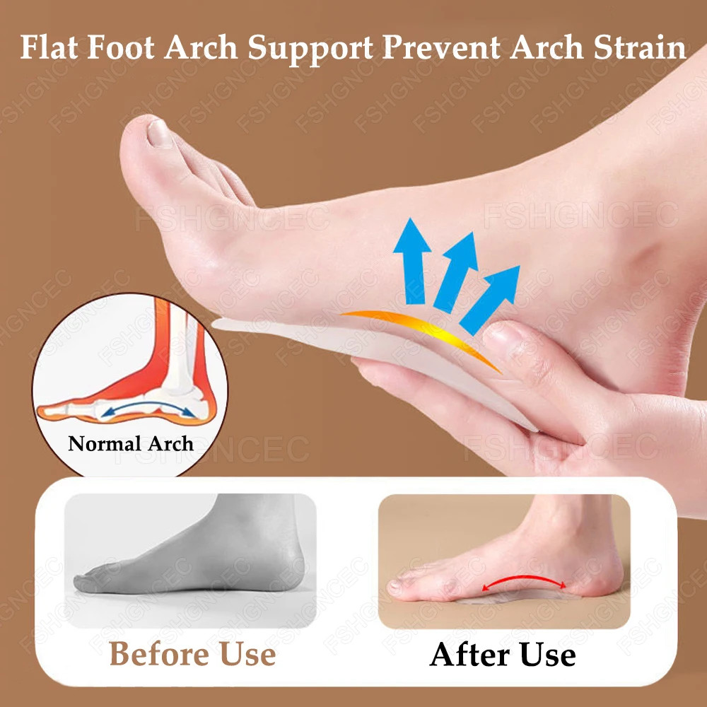 Silicone Arch Support Inserts for Men Women X-Type Legs and Flat Feet Orthopedic
