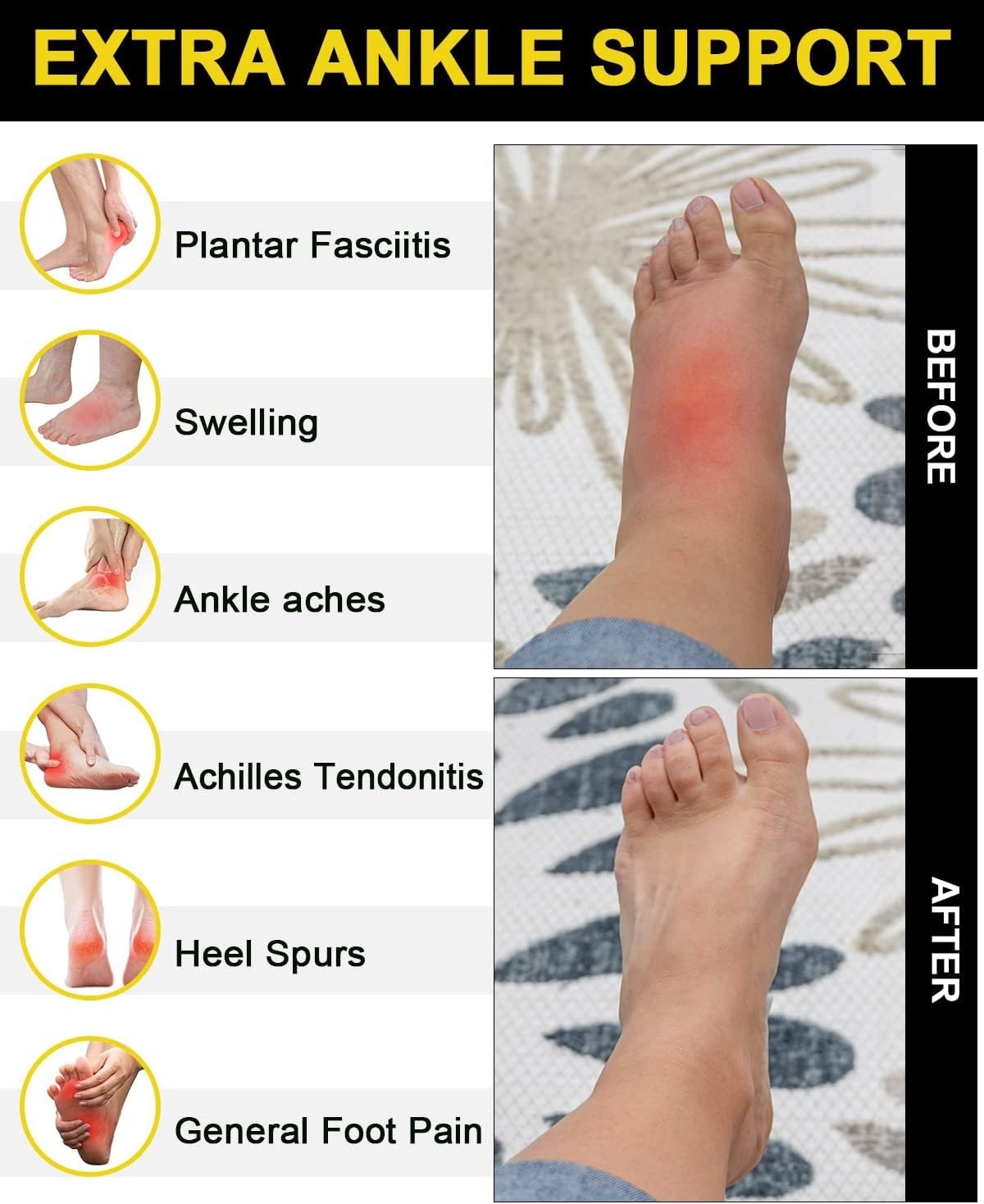 5 Pairs Copper Compression Socks for Ankle Support & Plantar Fasciitis Relief