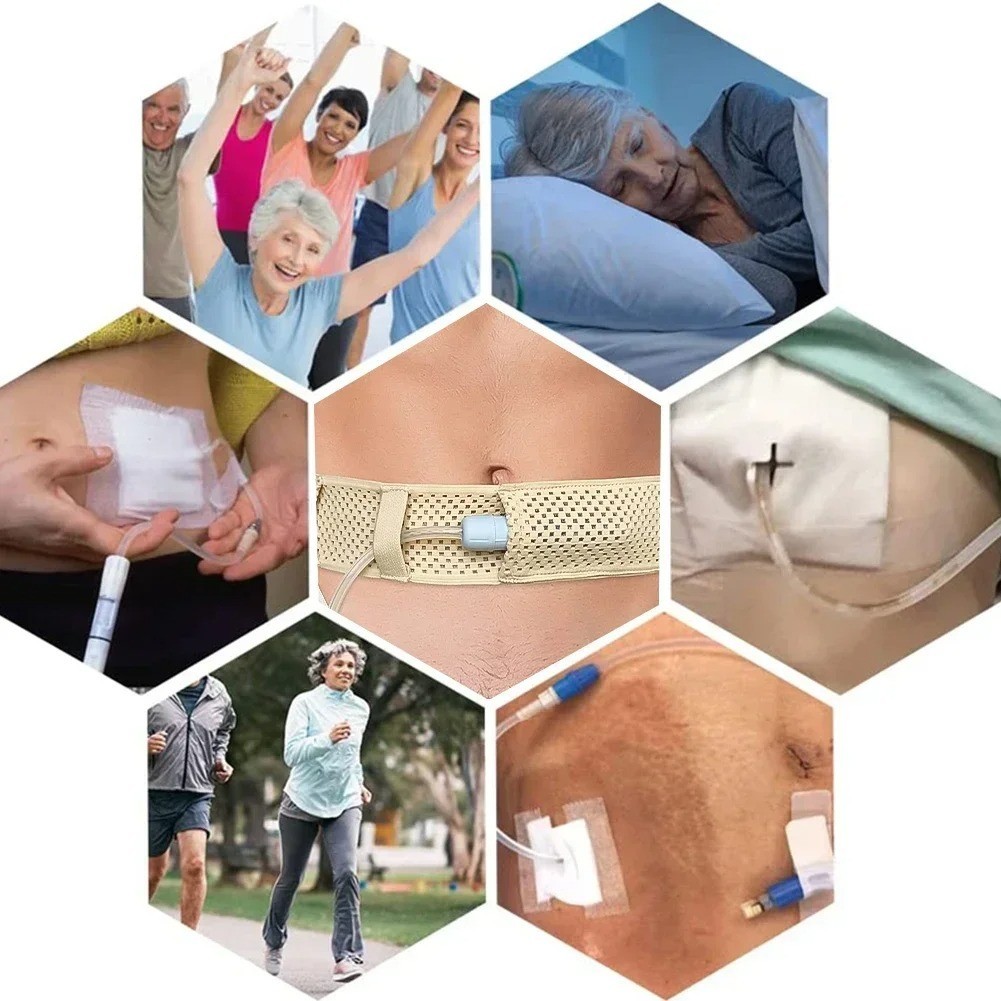 Peritoneal Dialysis Belt Mesh Breathable Catheter Care Adjustable Protection