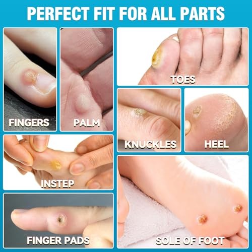 AstraVox 24Pcs Corn Removers for Toes Feet with Adhesive PU Waterproof Large