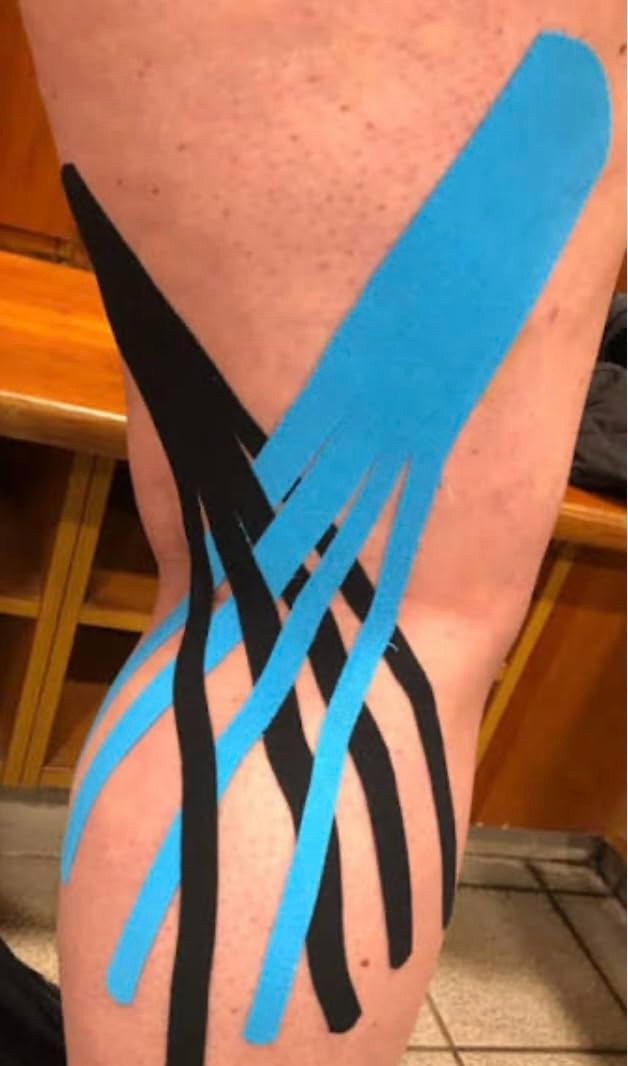 Elastic Kinesiology Athletic Tape – 20 Hypoallergenic 10-Inch Strips for Fitness