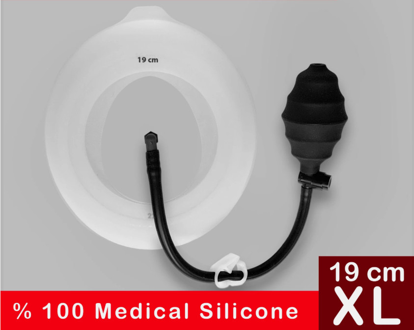 Vacuum bell pectus excavatum 19 cm
