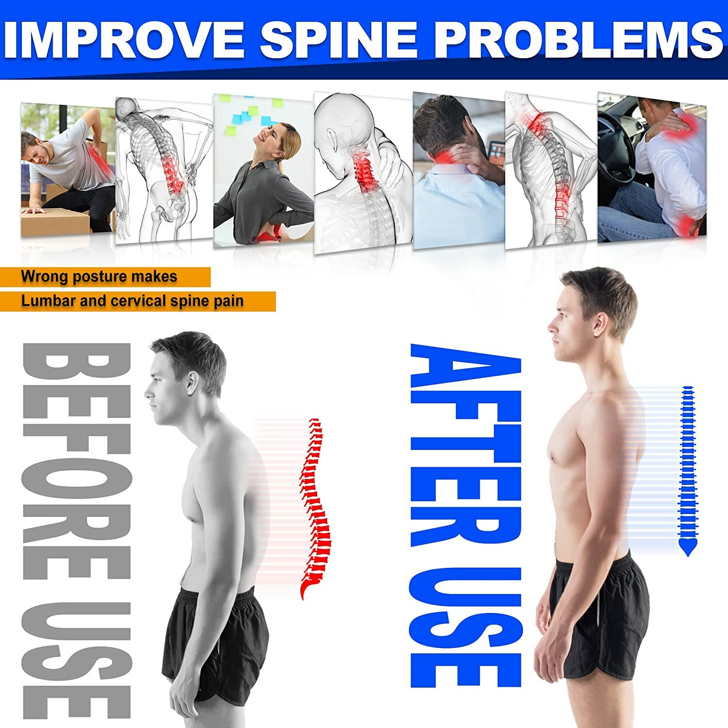 Back Brace Posture Corrector for Men Women Upper & Lower Back Pain Relief Corset
