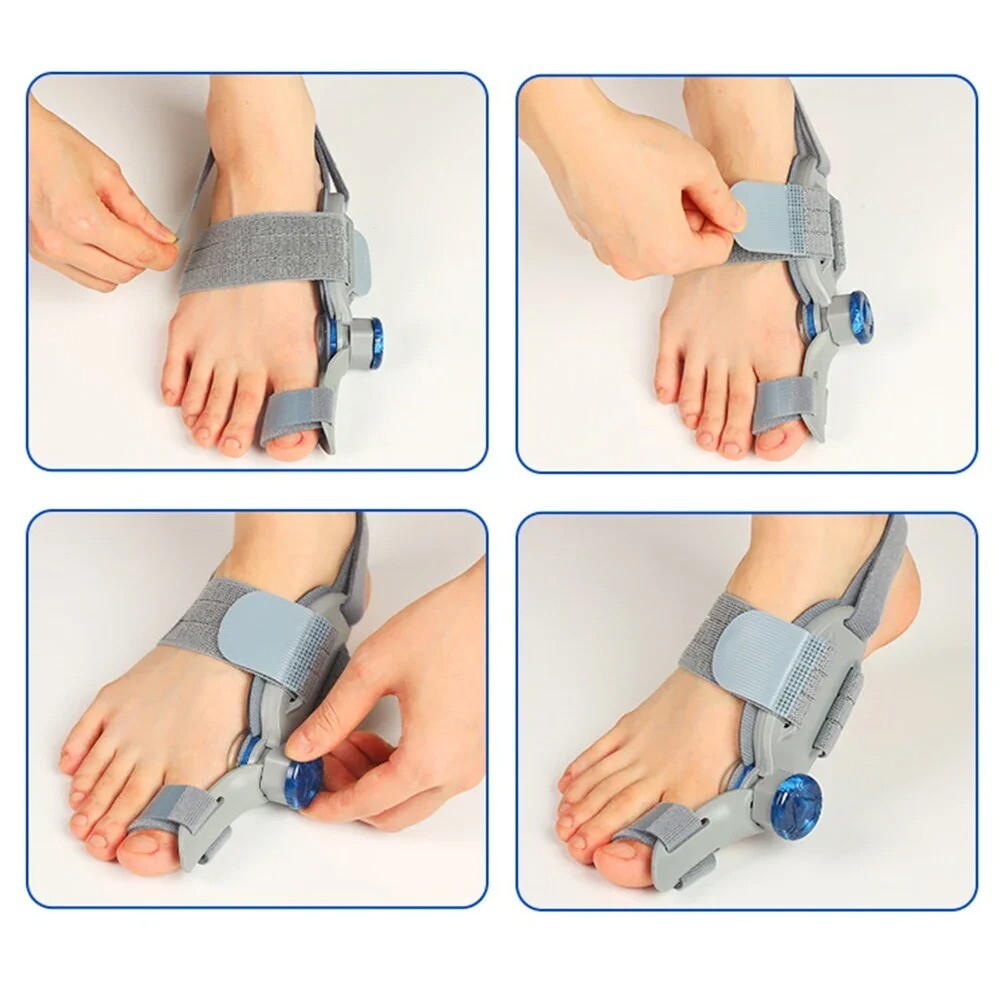 Bunion Correctors Adjustable Hallux Valgu for Big Toe Rotatable Straightener FNS