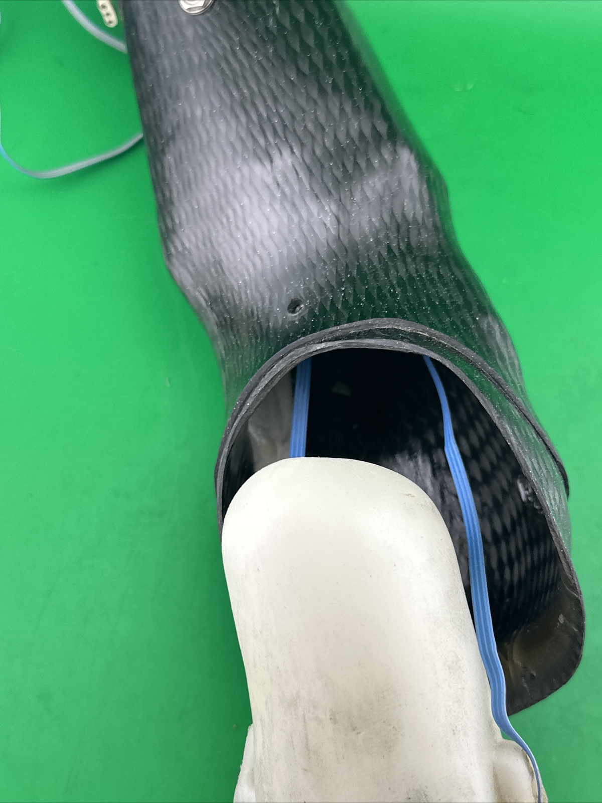 Below Elbow Prosthetic Socket W/ electrodes And Batteries No Charger/wrist Unit