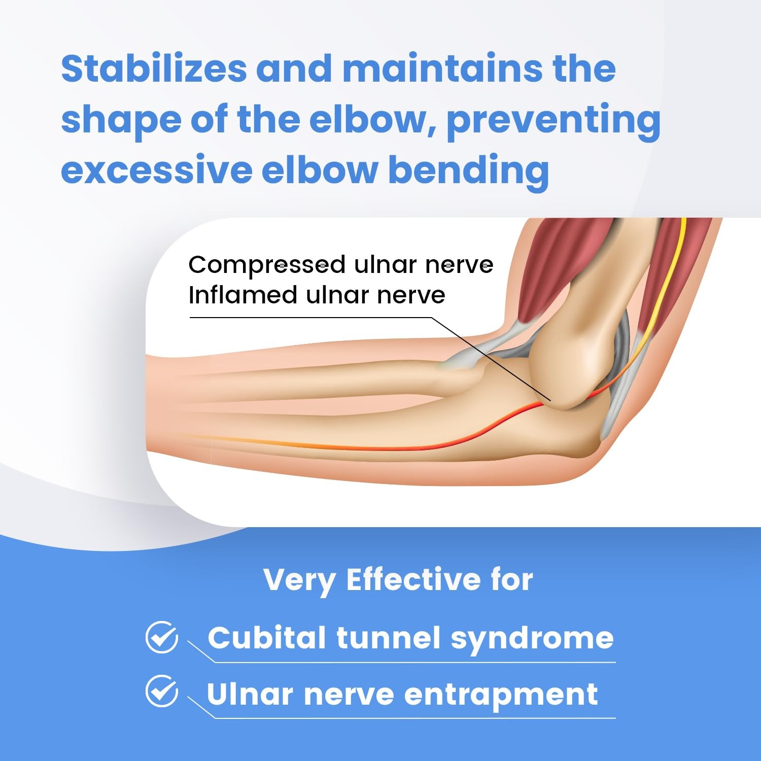 Cubital Tunnel Syndrome Elbow Brace, Ulnar Nerve Entrapment Splint, Elbow Immobi