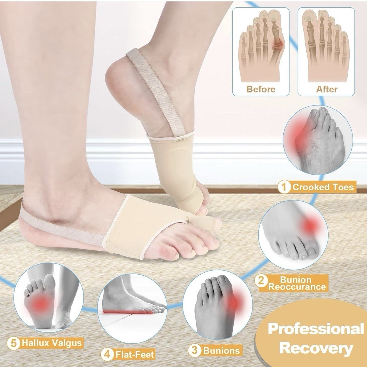 4 Pcs Bunion Corrector & Adjustable Toe Spacer with Heel Side Straps – Men/Women