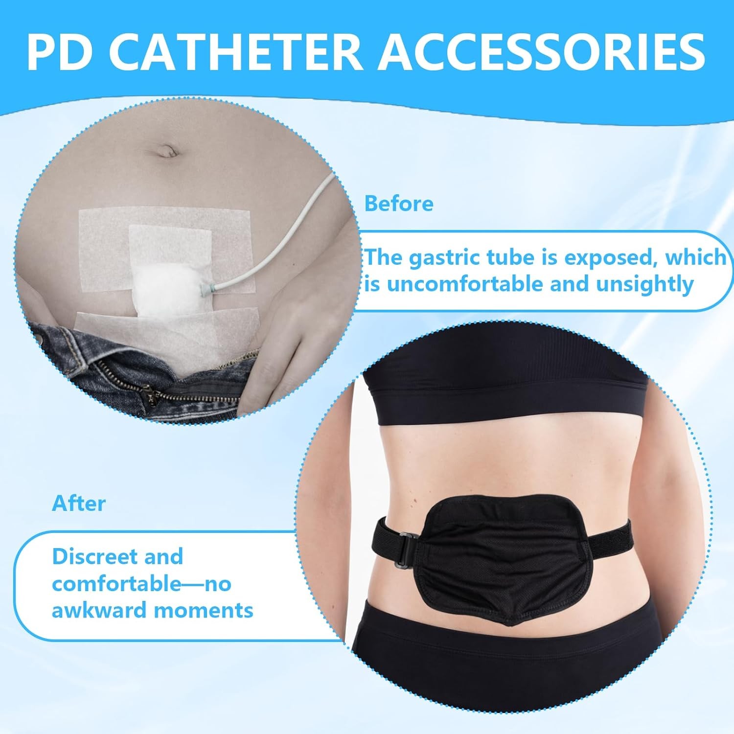 Adjustable Peritoneal Dialysis Belt PD Catheter Holder Feeding Tube Support