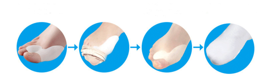 2PCS Silicone Toe Corrector Gel Bunion Spreader Corrector-Foot Care
