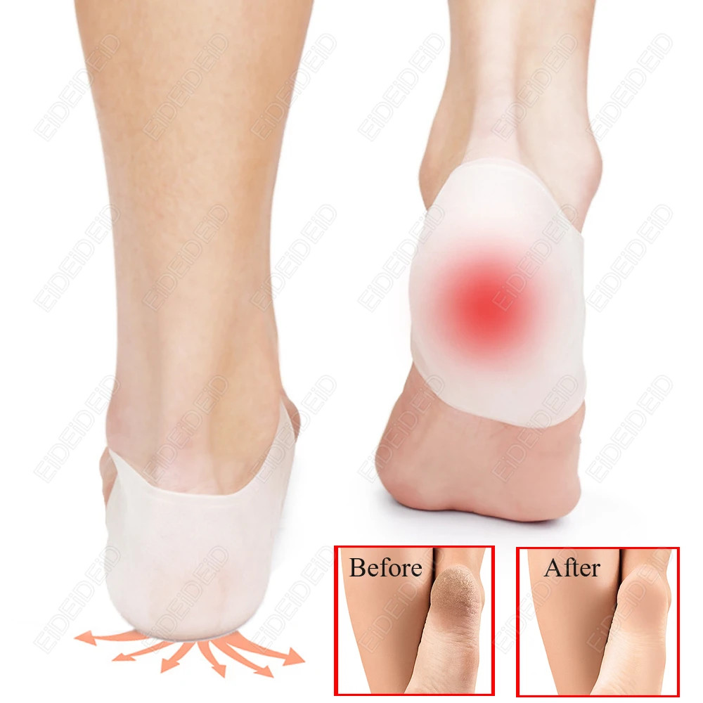 Gel Silicone Heel Protector Heel Cups Spurs Cracked Plantar Fasciitis Gel Heel P