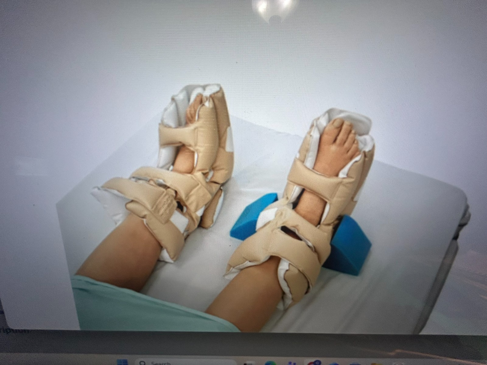 Waffle Heel Protectors for Management of Pressure Injuries (Heel Ulcers)