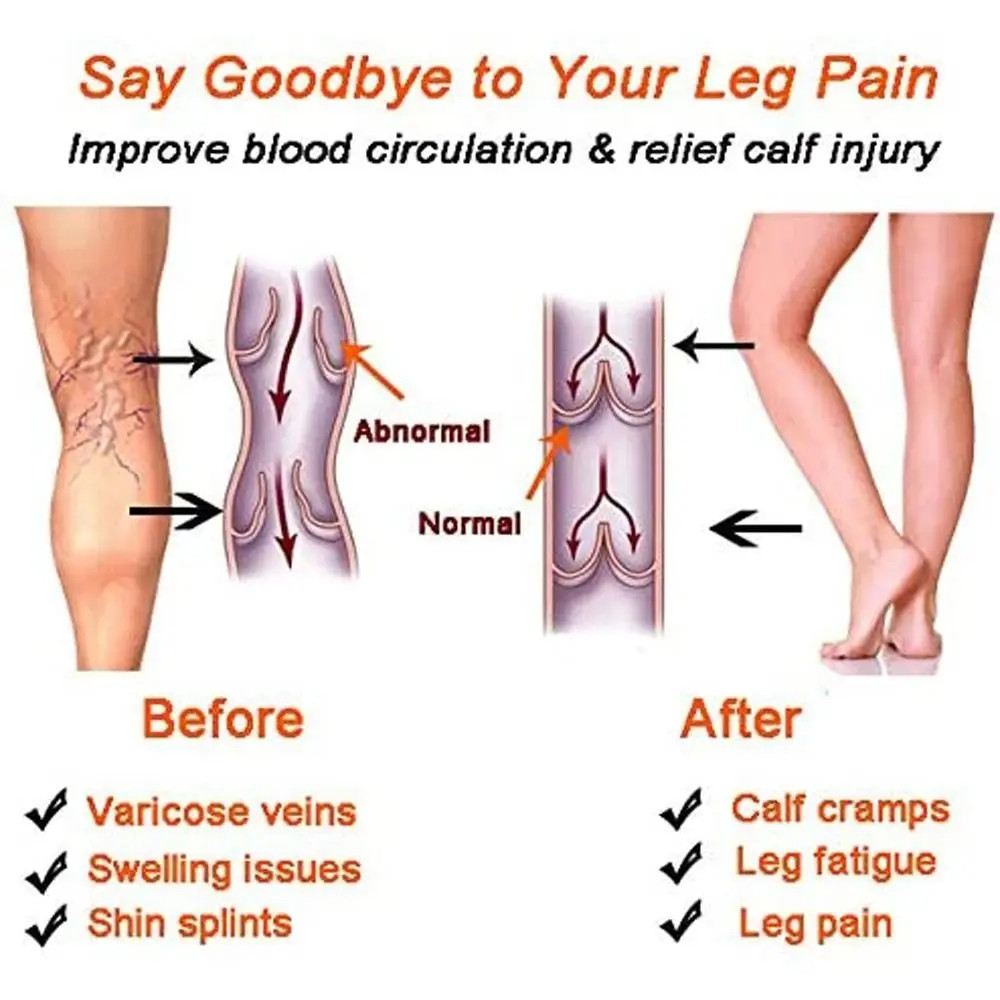 20-30mmHg Calf Compression Sleeve 2 Levels Pressure Breathable Calve