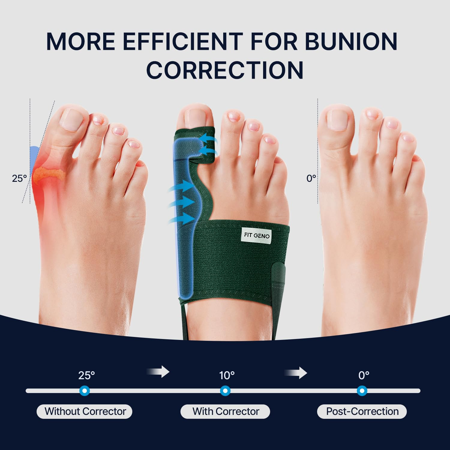 Adjustable Orthopedic Bunion Corrector Brace For Men And Women Relief