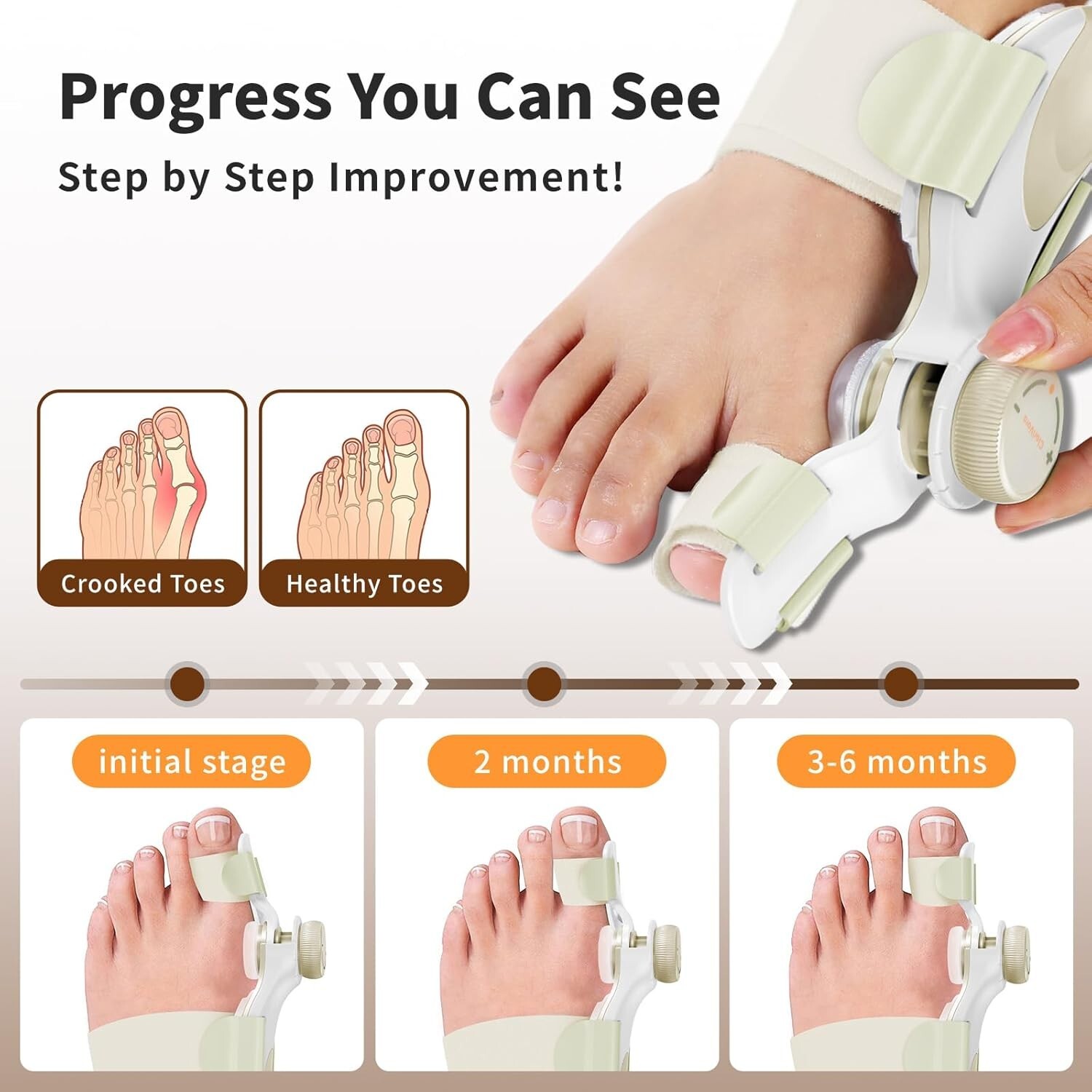 ClariVora Adjustable Bunion Corrector for Women and Men 3 Plate Design