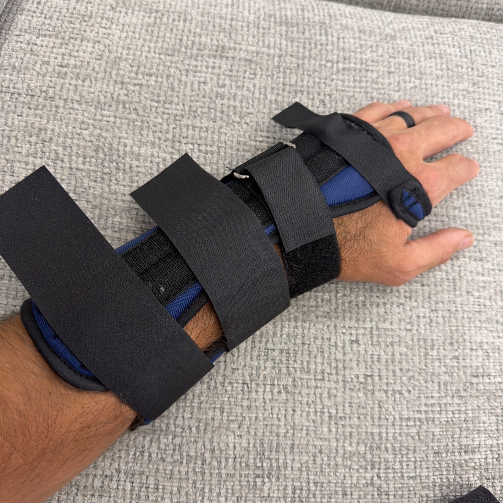 FOAM WRIST SPLINT, LEFT, LARGE, BLUE, PROCARE, STEEL IMMOBILIZATION