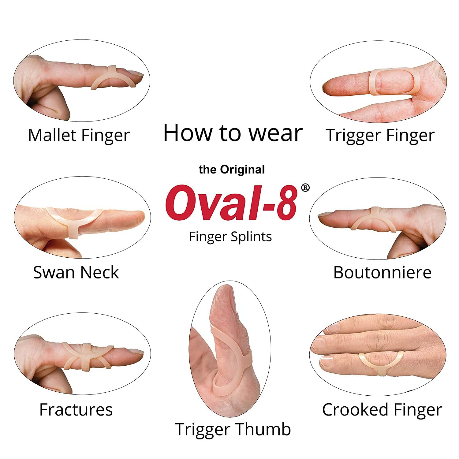 3-Point Products Oval-8 Finger Splints (Pack of 1) (Size 2)
