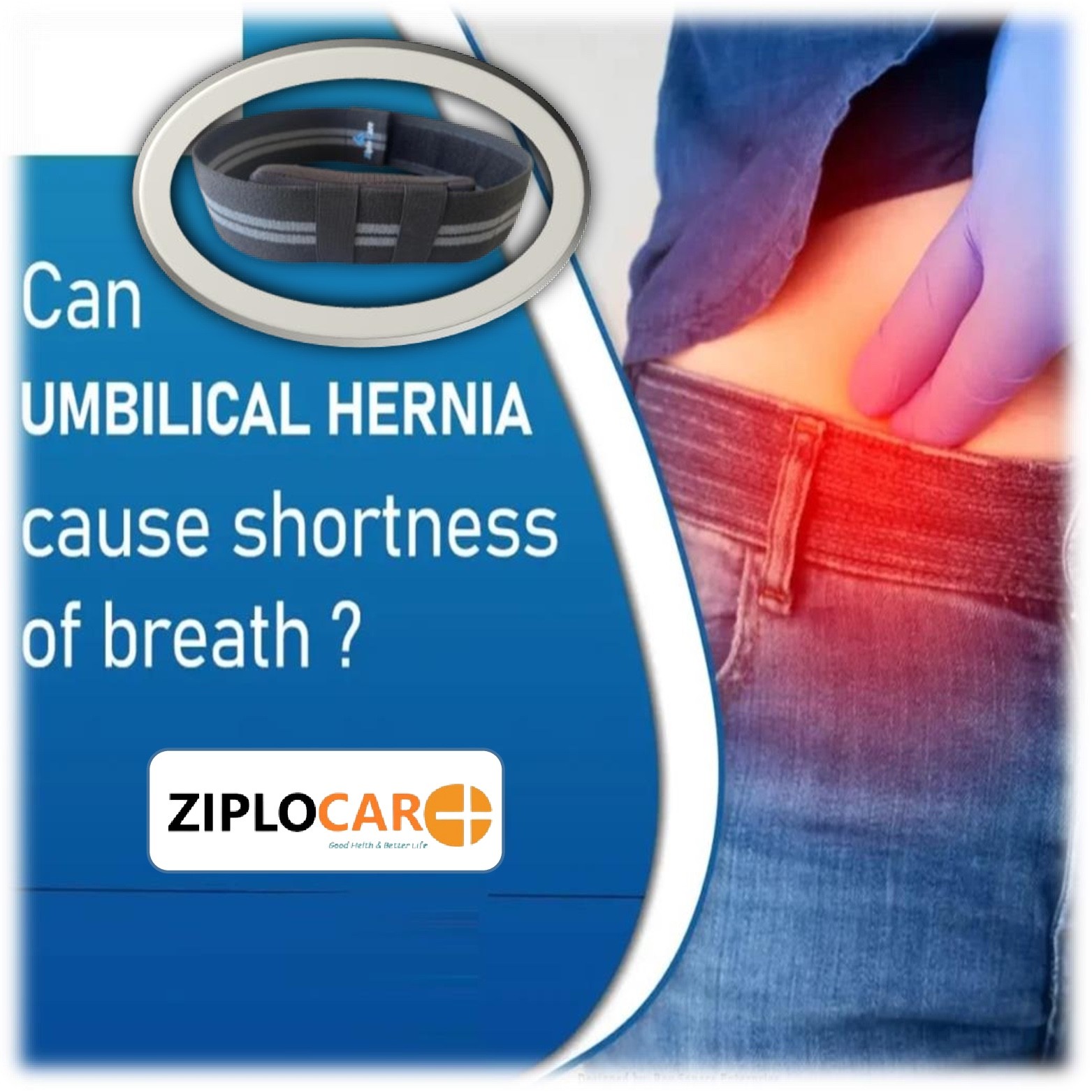 Beige Umbilical Hernia Support Belt Abdominal Navel Truss One Removeable Cushion