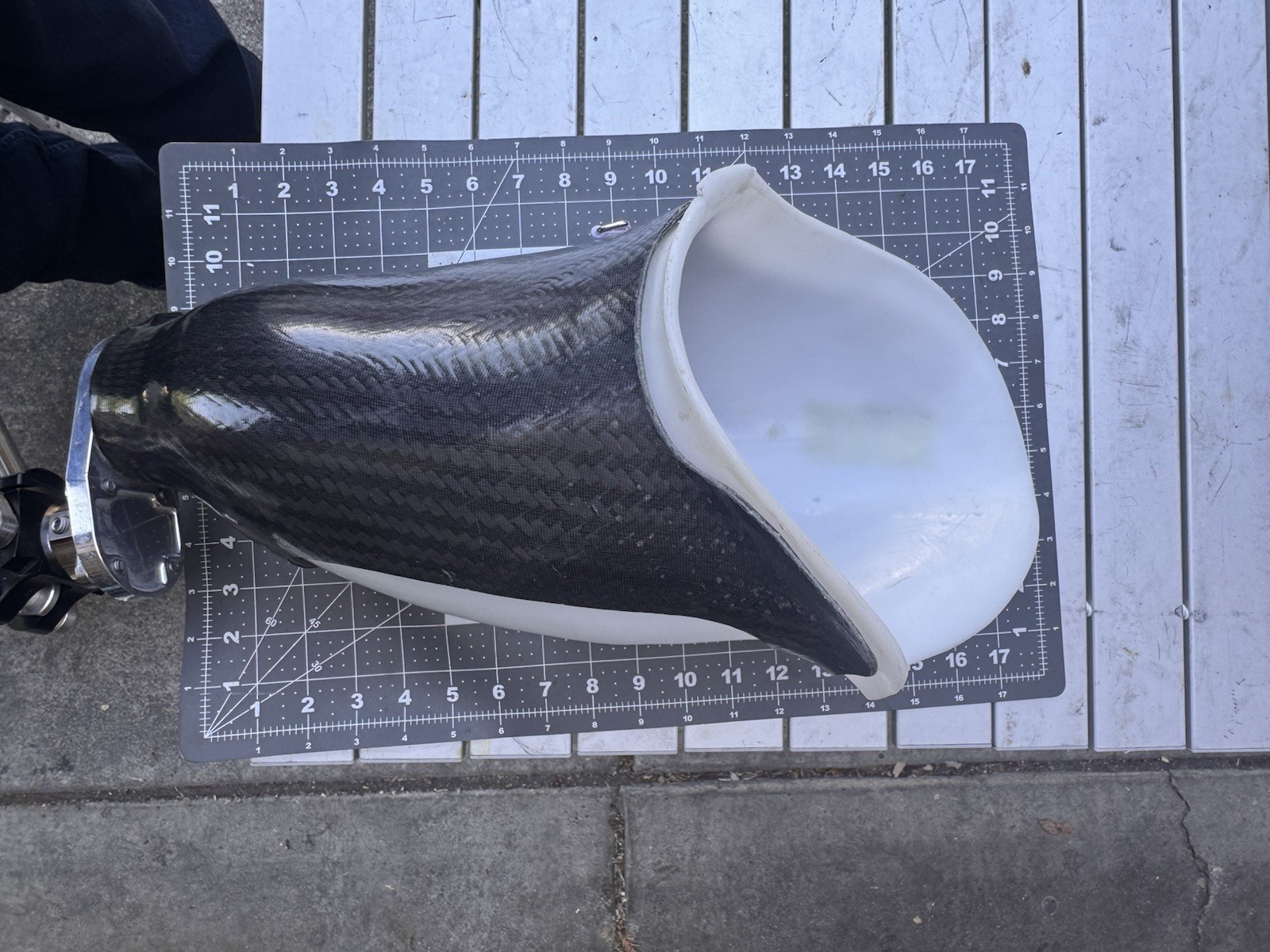 Complete Above-Knee Right Prosthetic Leg. Trulife, Ossure, Kiss, Lapoc/Swan