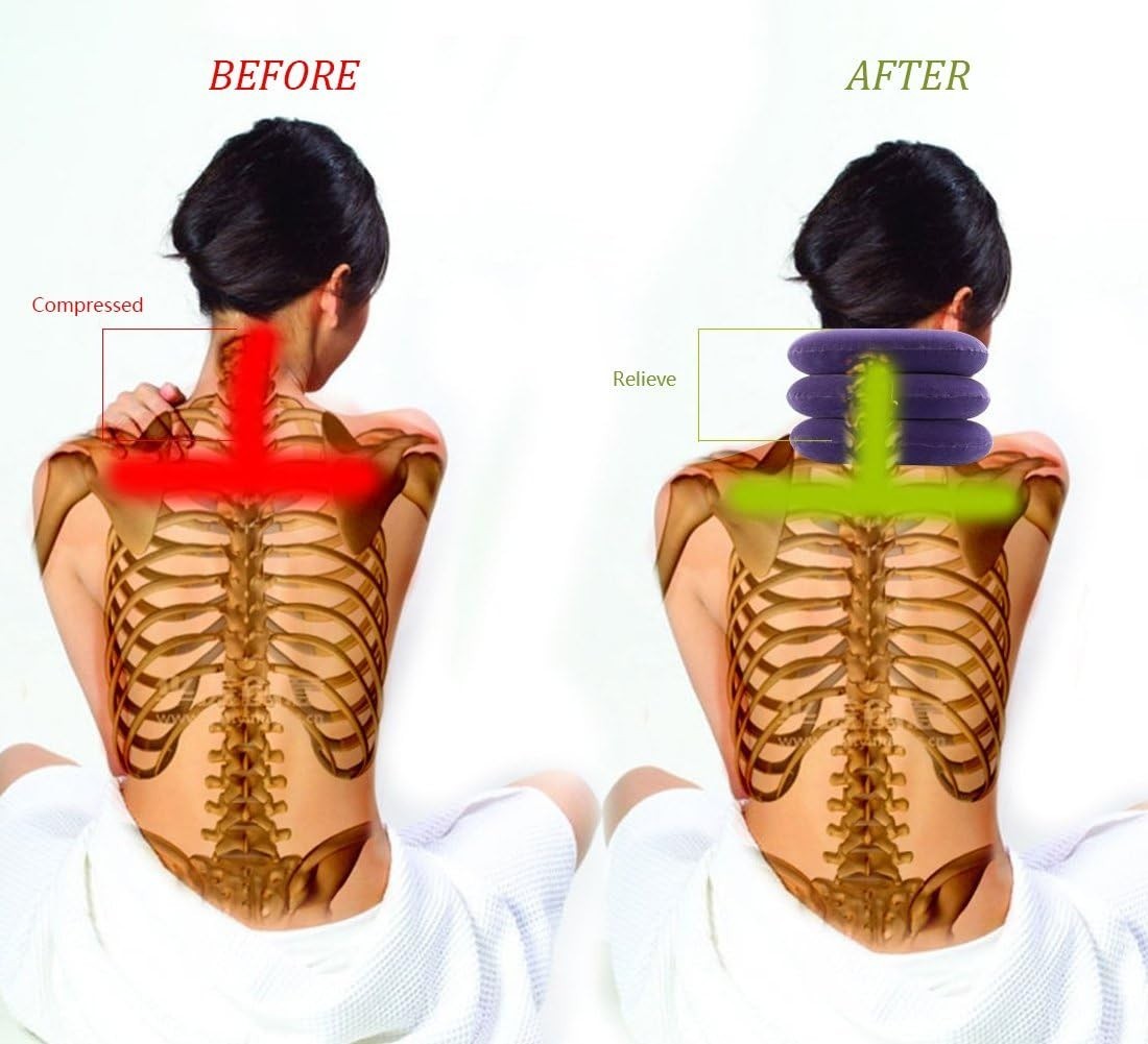 Purple Cervical Neck Traction Device – Lightweight & Easy to Use for Pain Relief