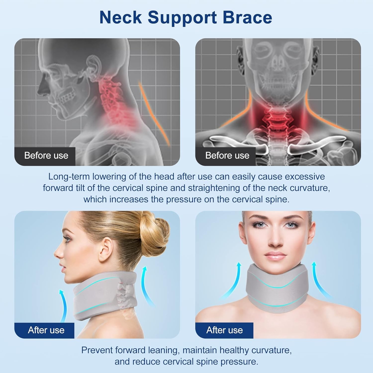 Neck Brace for Neck Pain and Support, Soft Neck Support Relieves Pain & Pressure