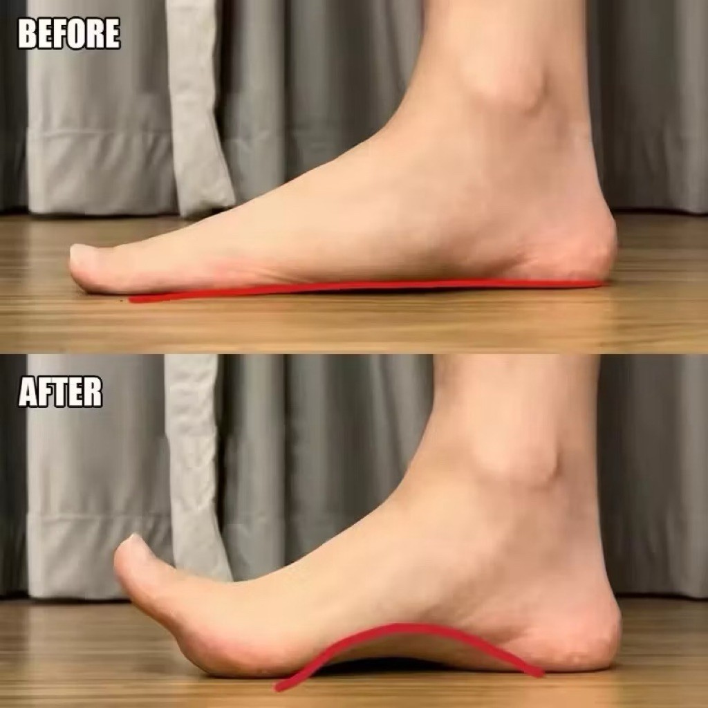 ArchCare Rigid Arch Support Insole Orthopedic Half Insole Hard Arch Pad Support