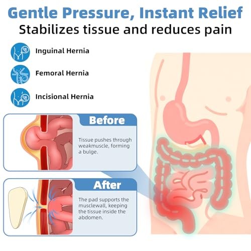 Inguinal Hernia Belt for Men & Women – Adjustable Medium (Pack of 1)