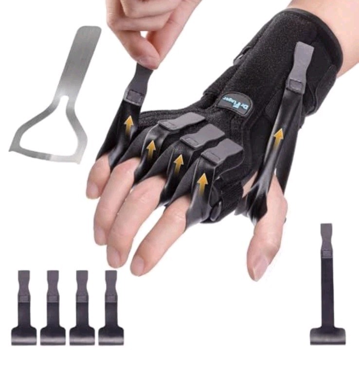 Radial Nerve Palsy Splint Brace for Wrist Drop 5 Fingers Extension Smoke Patient