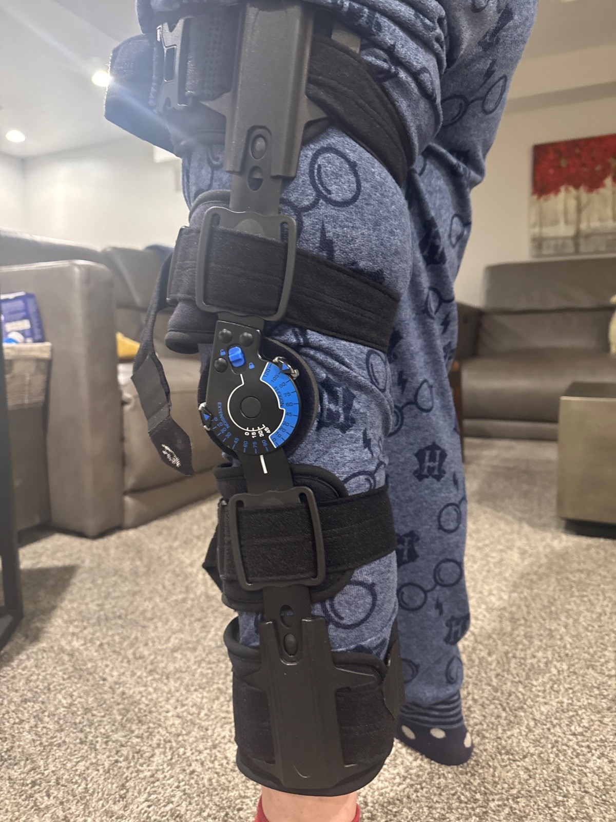 CSUS by Allard Post Op Knee Brace – Black (08814)