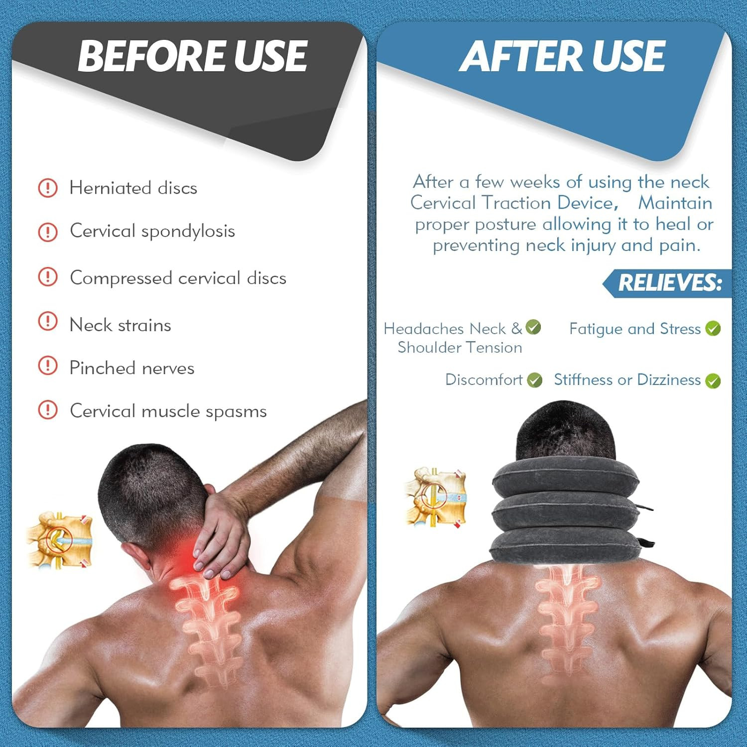 Neck Stretcher Cervical Traction Device – Adjustable Inflatable Neck Brace for N
