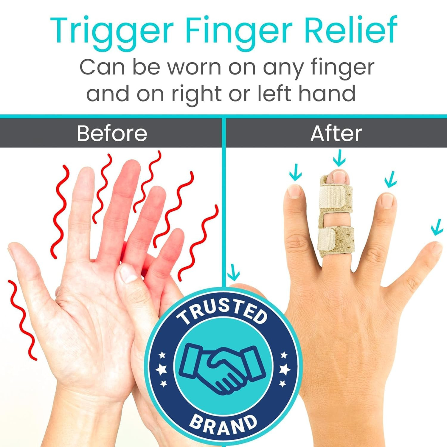 Vive Finger Splint (2 Pack) – Universal Finger Straightener – Broken and Trigger