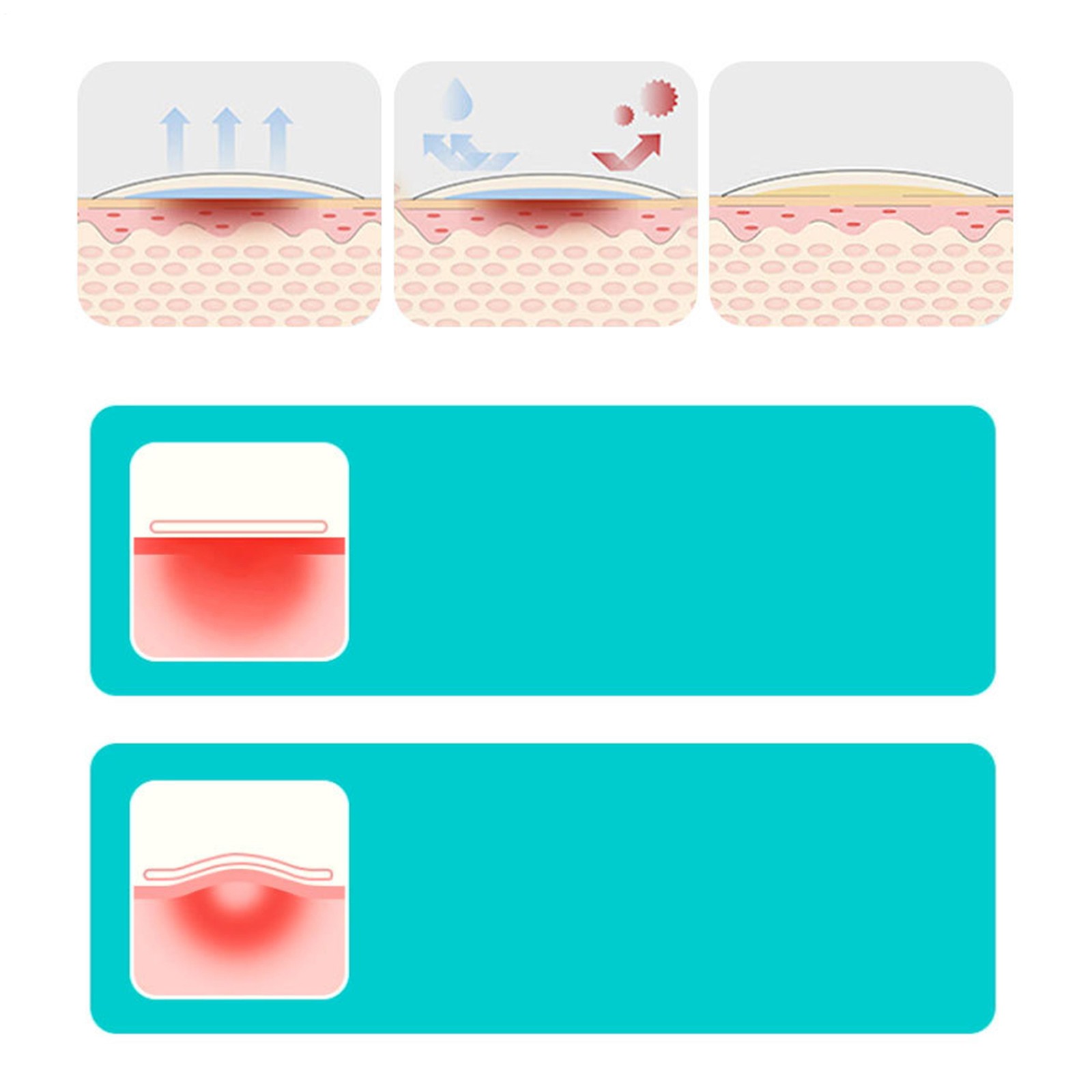 Hydrocolloid Roll Hydrocolloid Tape Flexible Breathable Moist Patch 1.96inx9.8ft