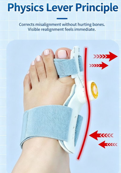 Bunion Corrector for Women & Men – Adjustable Big Toe Splint Gray-1PACK