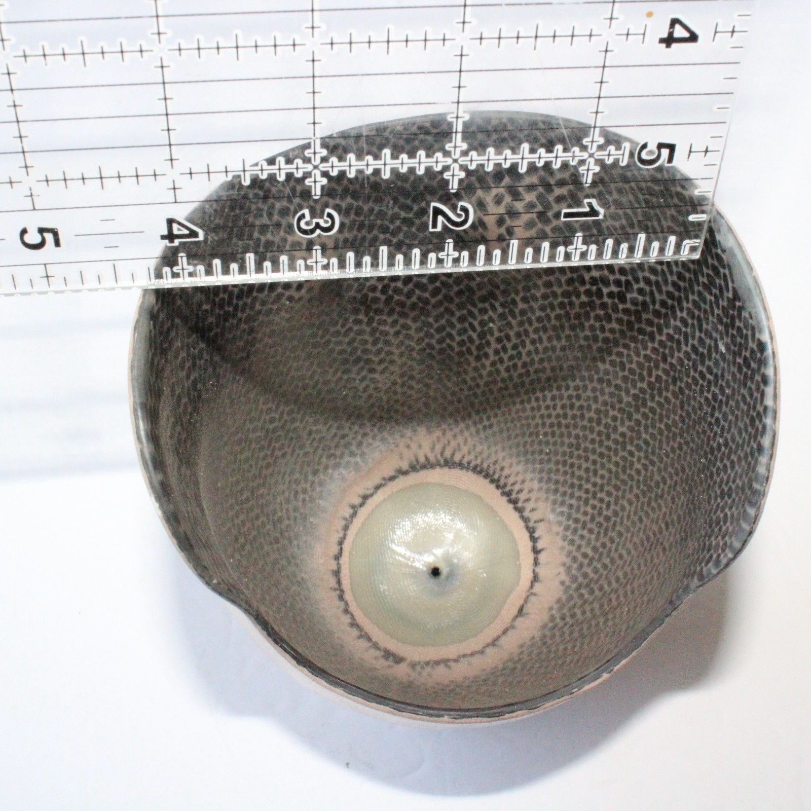 VERY NICE BELOW-KNEE PROSTHETIC SOCKET w/ EVOLUTION VMP-001 DISTAL BASE