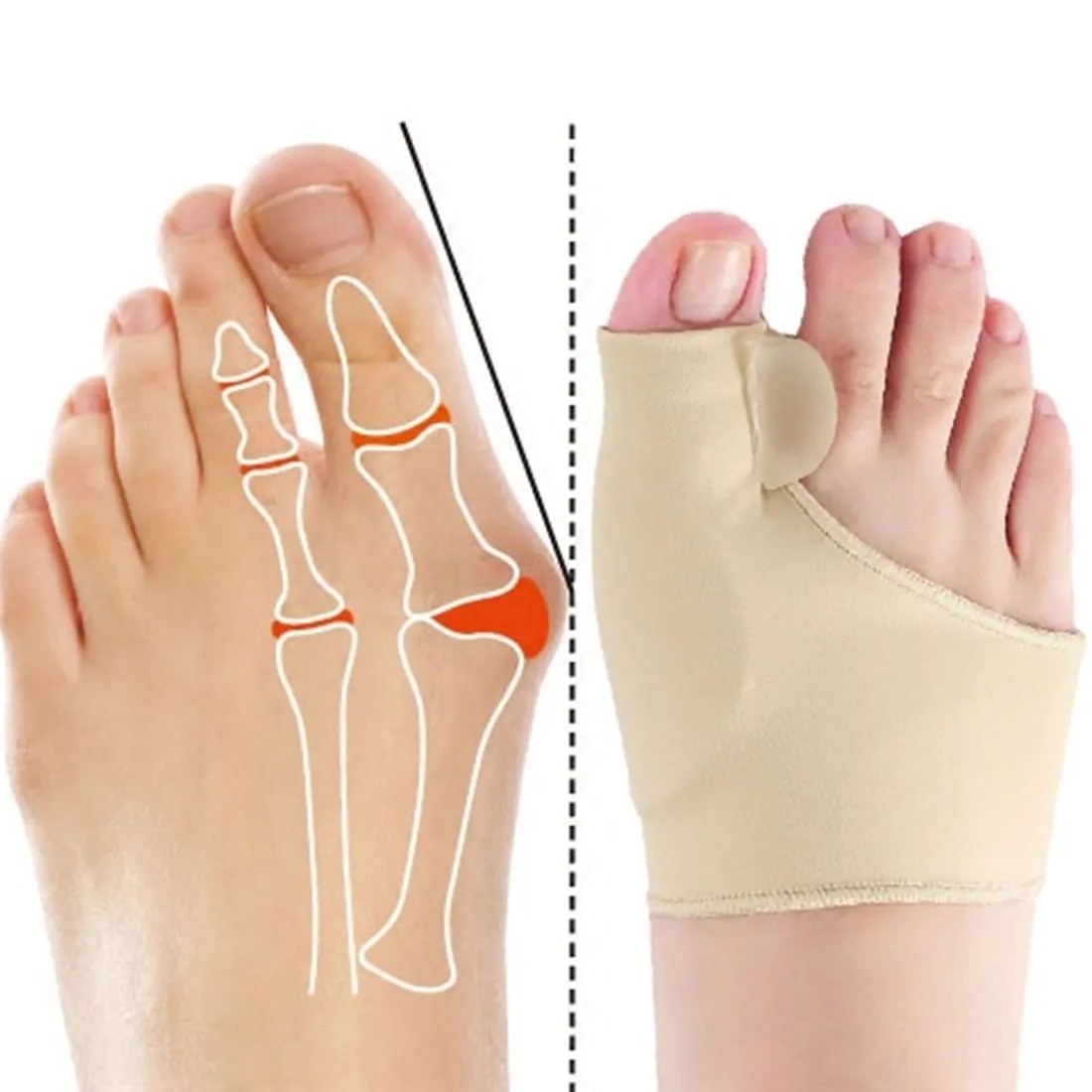 Toe Separator Hallux Valgus Bunion Corrector Orthotics Feet Pain Relief Sleeve