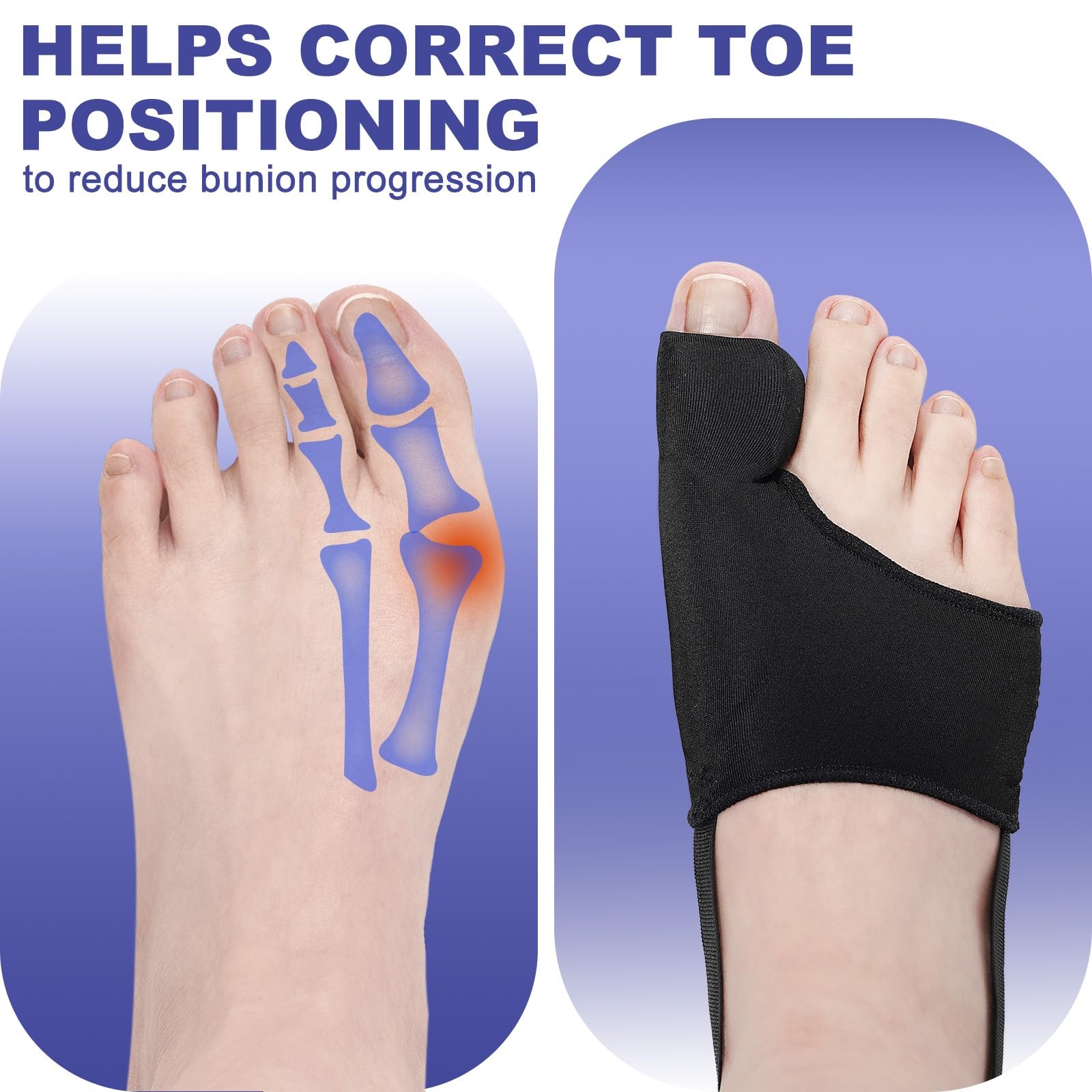 2 Pcs Bunion Corrector for Women & Men Big Toe Straightener-Bunions Correctio…