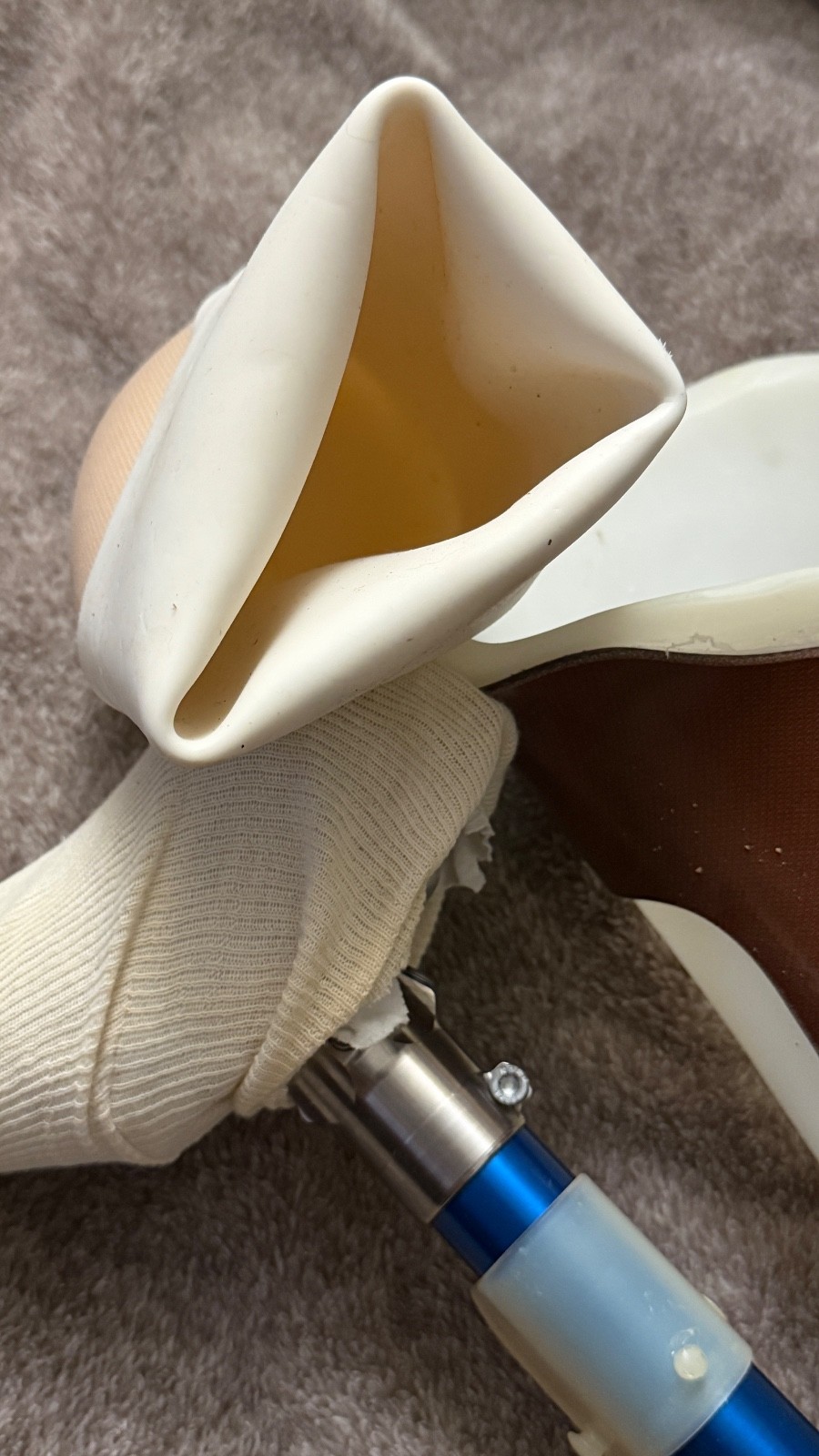 Vintage Ottobock Titan Left – Above the knee with Original Stub