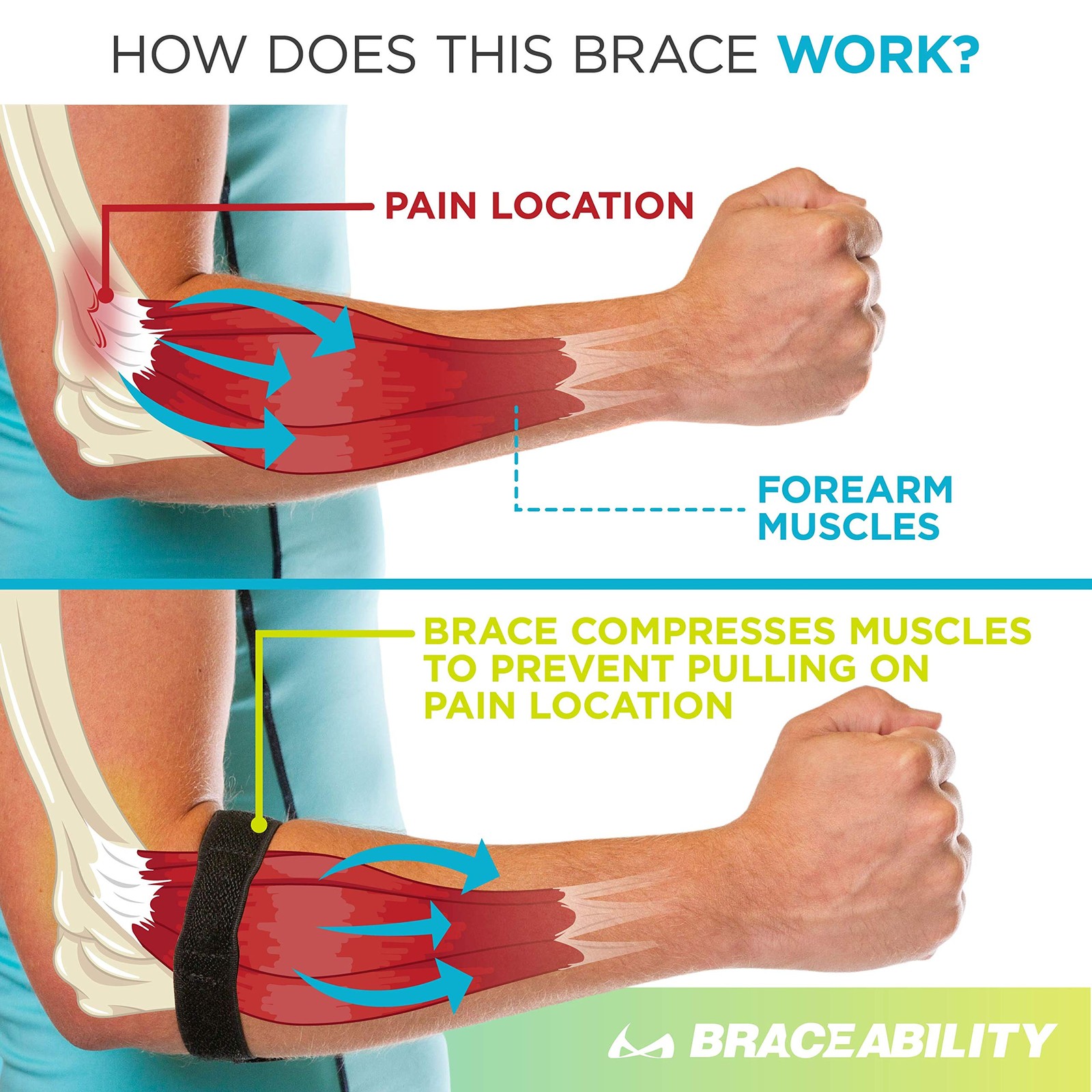BraceAbility Epicondylitis Brace | Elbow Strap for One Size, Black