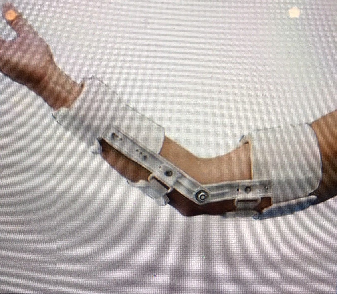 Rolyan Smith/Nephew Preformed Elbow Hinge Splint A517, LOWEST PRICE, NEW