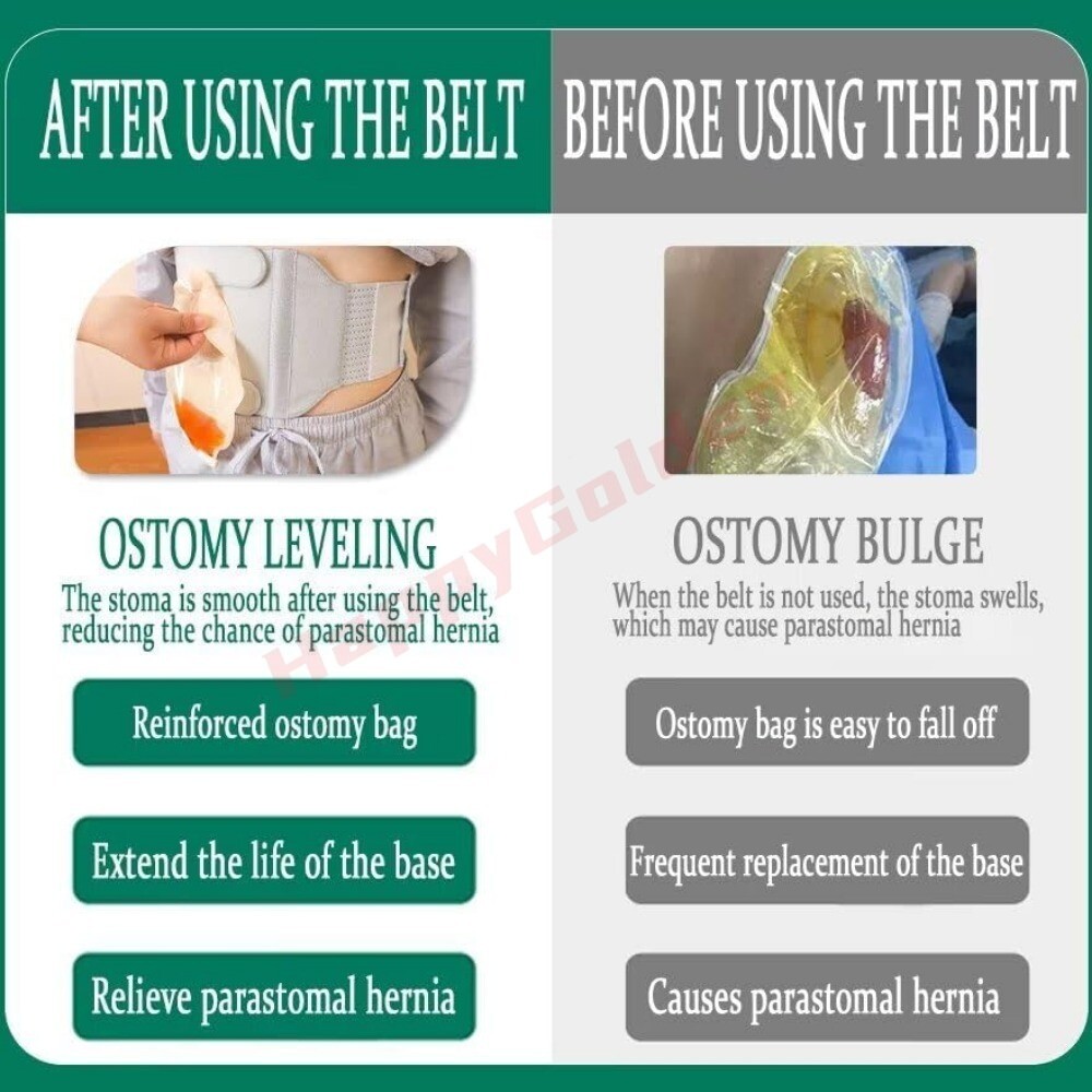 Abdominal Ostomy Belt Adjustable Stoma Support Portable Ileostomy Colostomy Belt