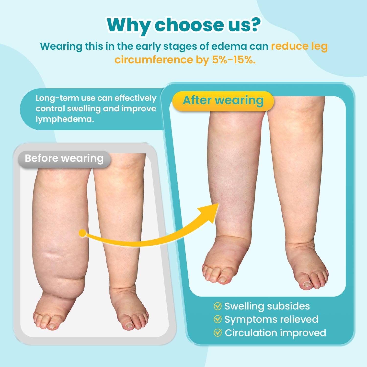 Sylong Calf Foot Compression Wrap Sleeve XL