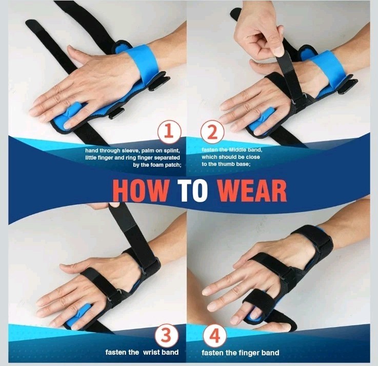 Featol Unisex Sz. Small Boxer Fracture Splint / Trigger Finger Splint. L Hand