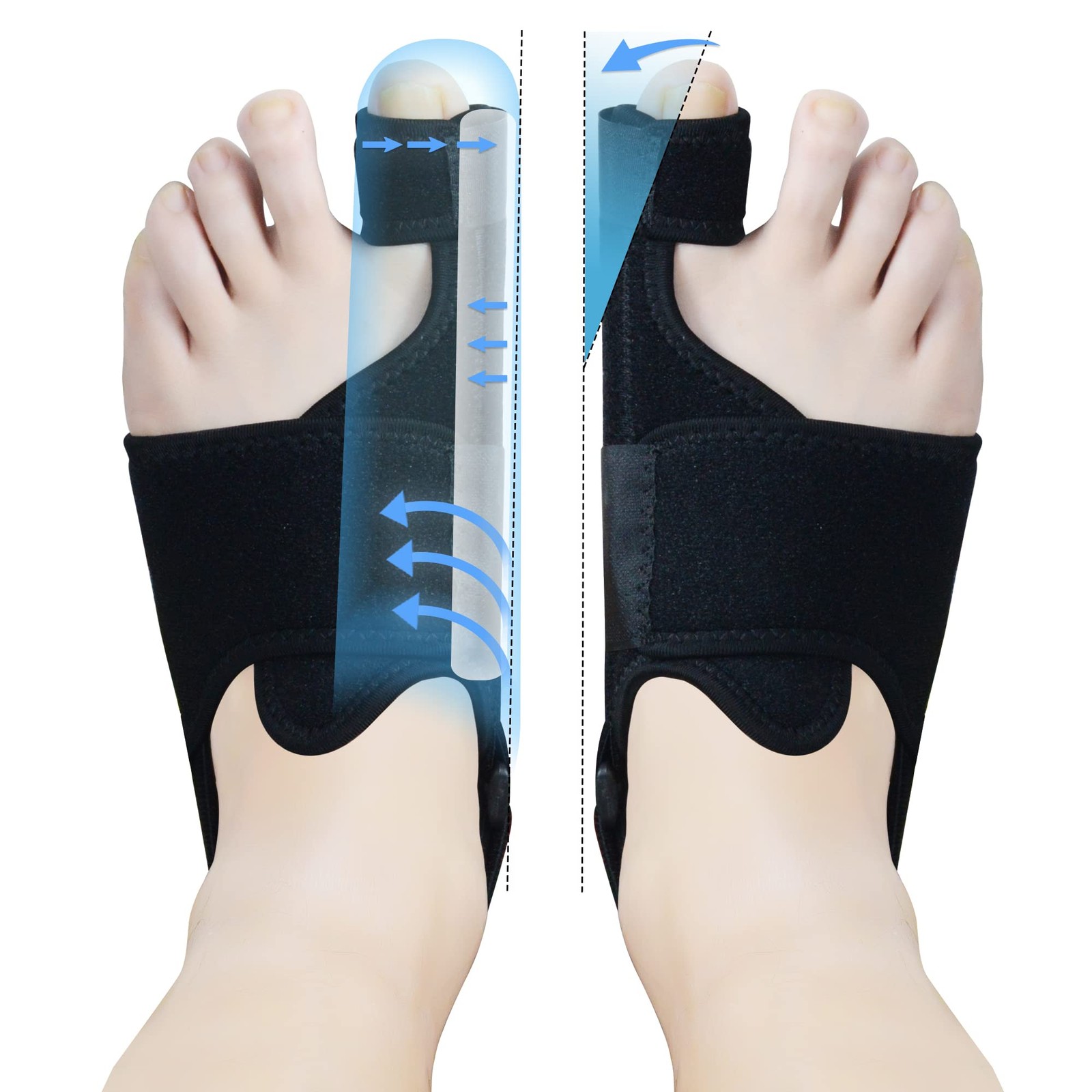 MOONSMILE 1 Pair Foot Bunion Corrector for Women & Men, Night One Size, Black
