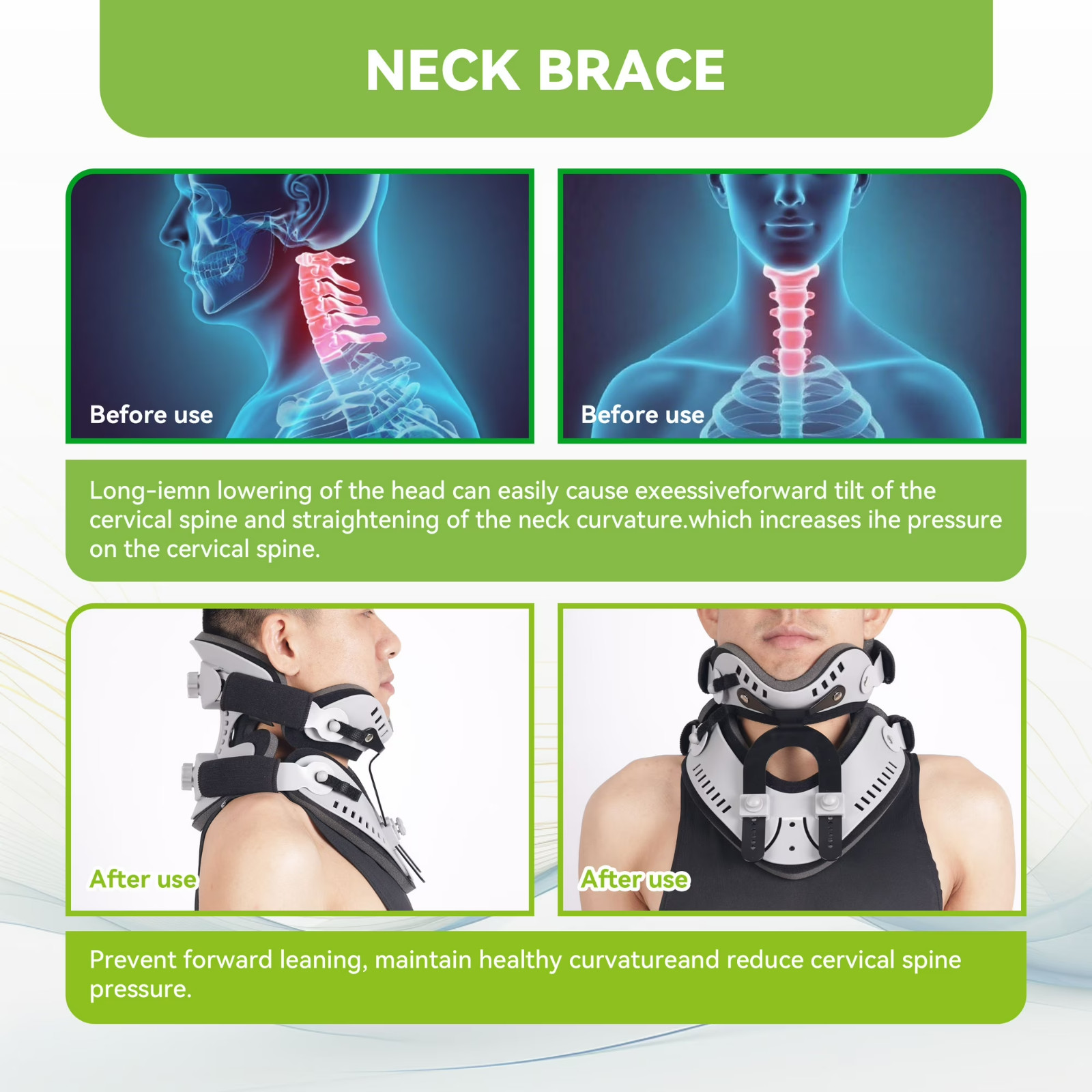 Neck Brace by Cervical Collar for Relieves Pain and Pressure in Spine, One Size