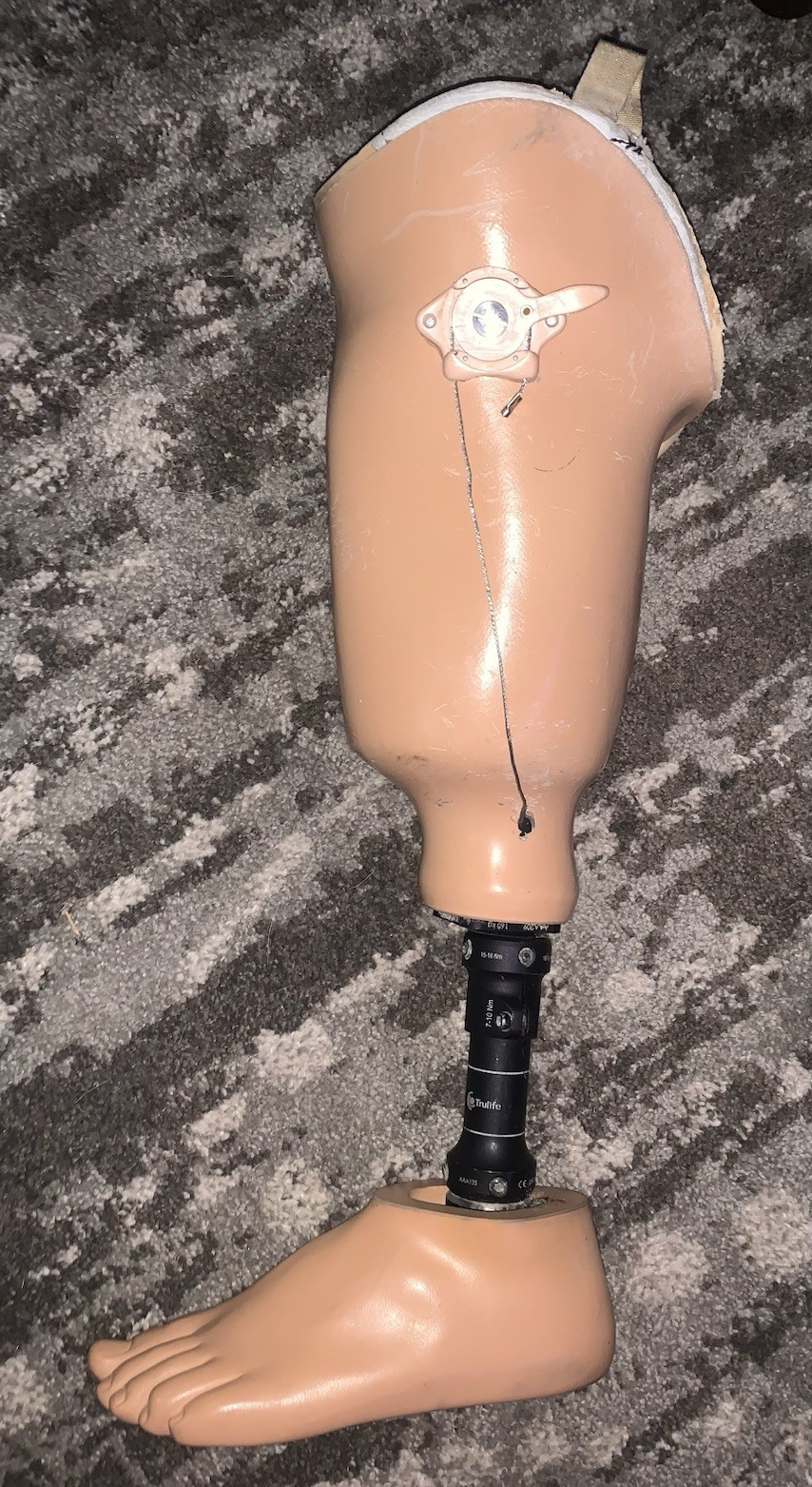 Trulife AAA135 Prosthetic Leg & Foot w/ Pylon Hardware 15-18 Nm Beige/Black