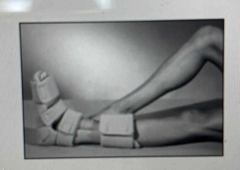 Maramed Passive Night Splint for Plantar fascia and Achilles tendon