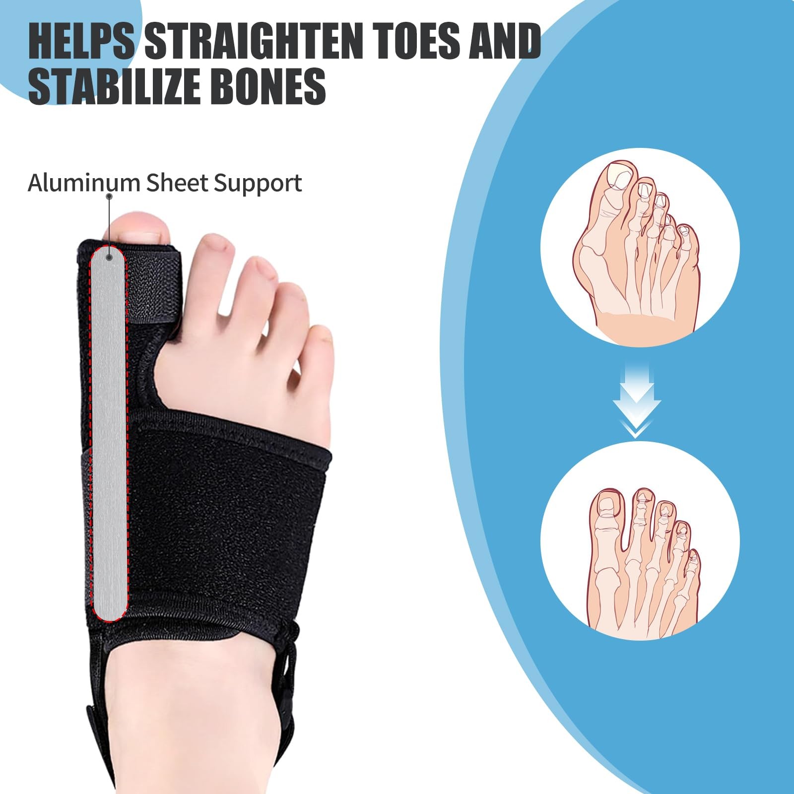 Recovist Bunion Brace for Women & Men – Corrector & Big Toe…
