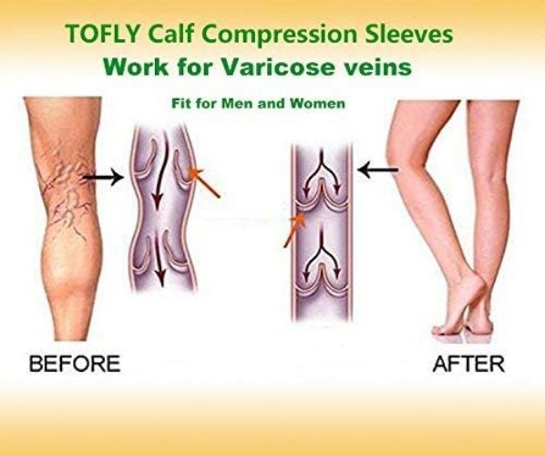Calf Compression Sleeve for Men & Women, 1 Pair, Footless Compression Socks 2…