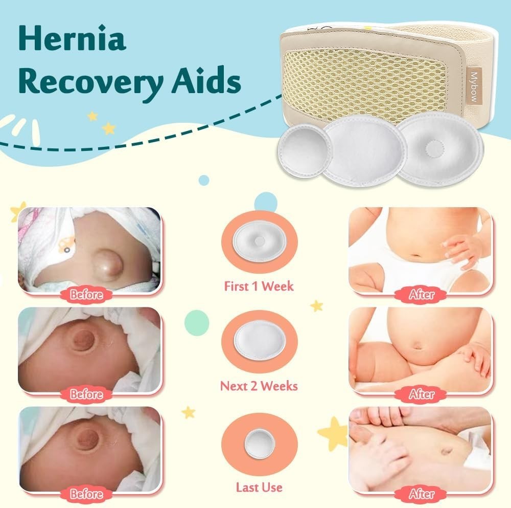 Infant Belly Button Binder for Hernia Relief