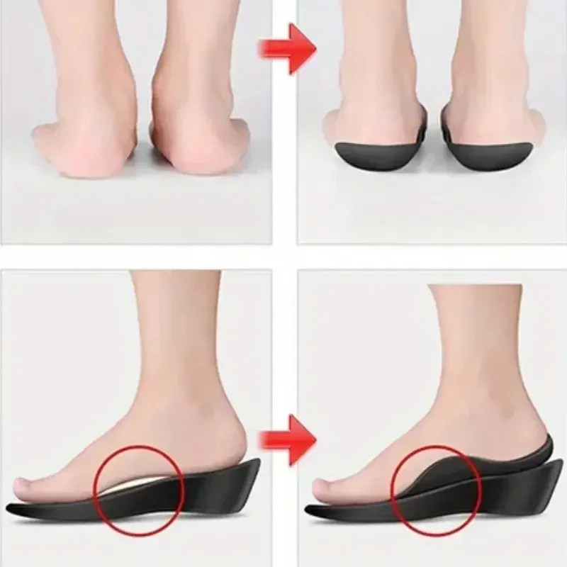1 Pair Arch Support Inserts – Comfortable TPR Material, Ideal for Men & Women, U