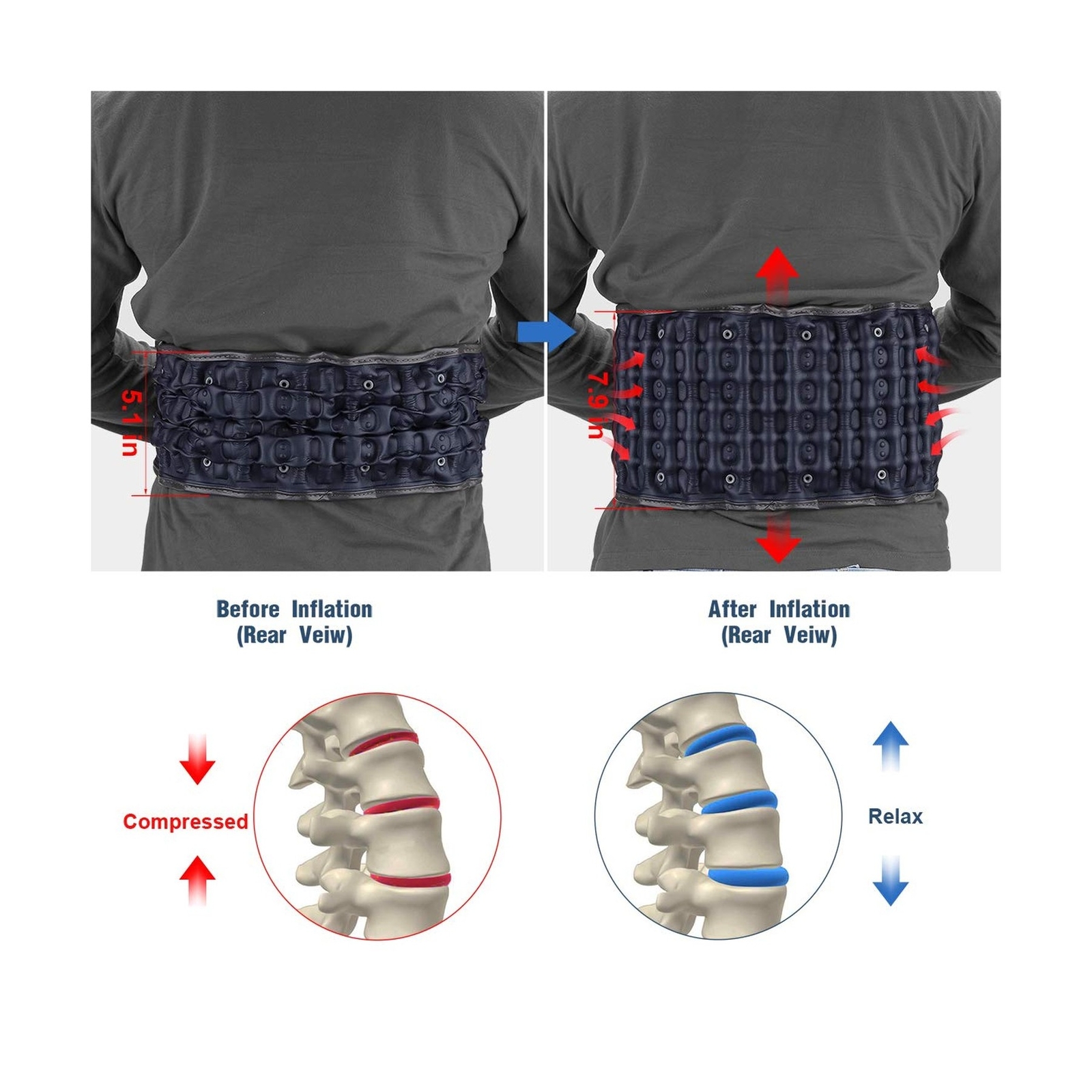 HONGJING Decompression Back Belt for Lower Back Pain Relief- Spine Reset Devi…